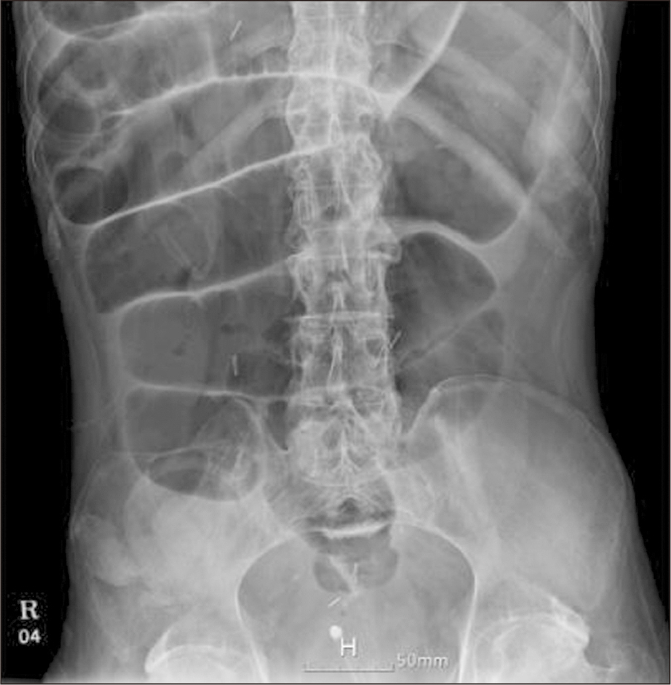 acnm-14-2-93-f2.jpg