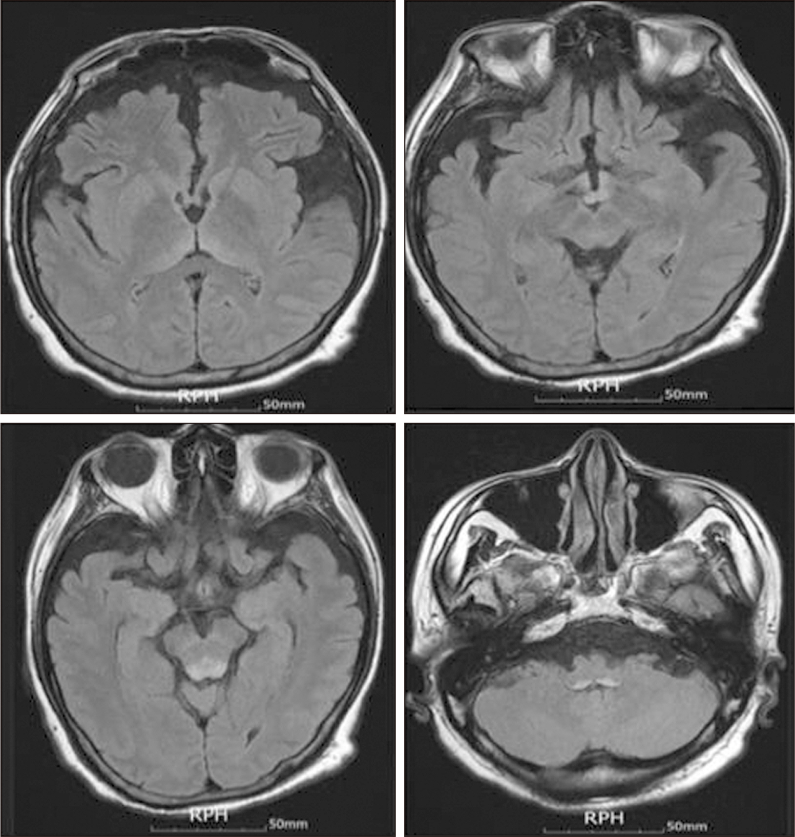 acnm-14-2-93-f3.jpg