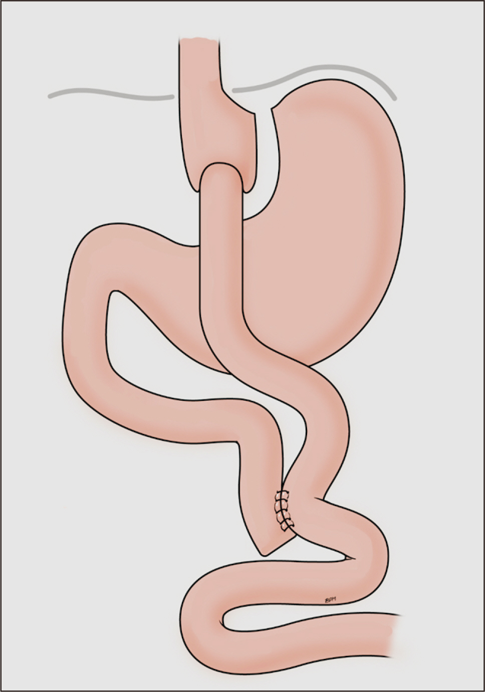 acnm-16-3-120-f1.jpg